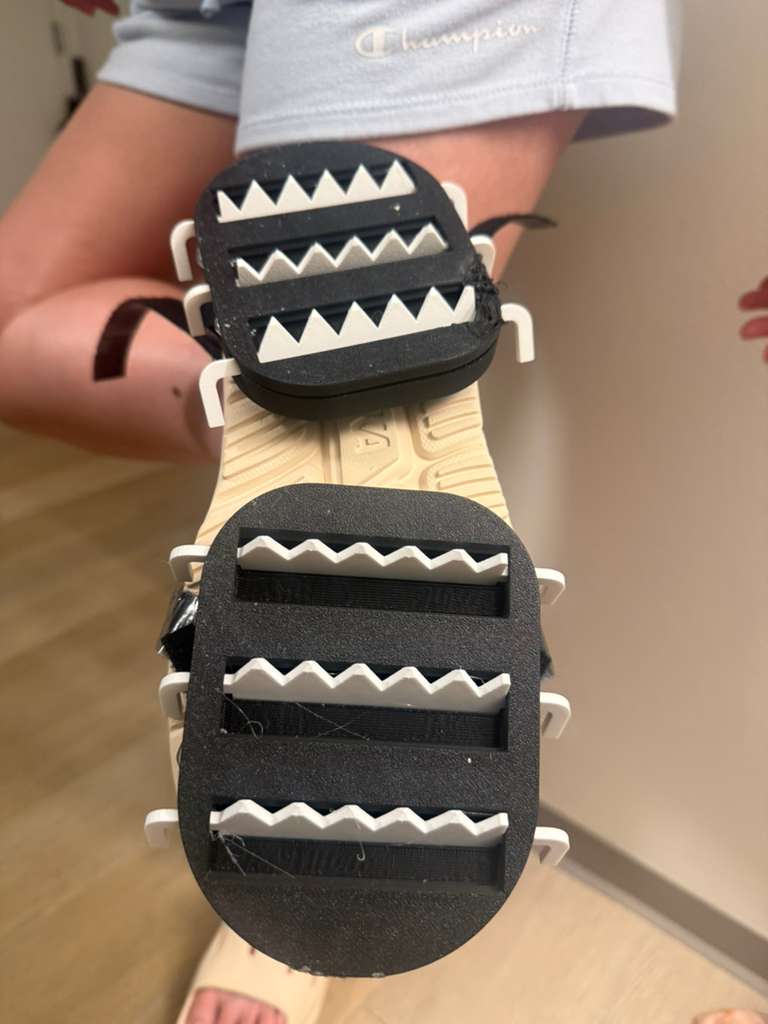 Early Prototype